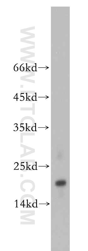 WB analysis of A2780 using 20388-1-AP