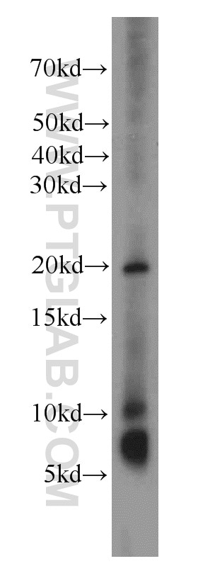 Western Blot (WB) analysis of A2780 cells using TMEM70 Polyclonal antibody (20388-1-AP)