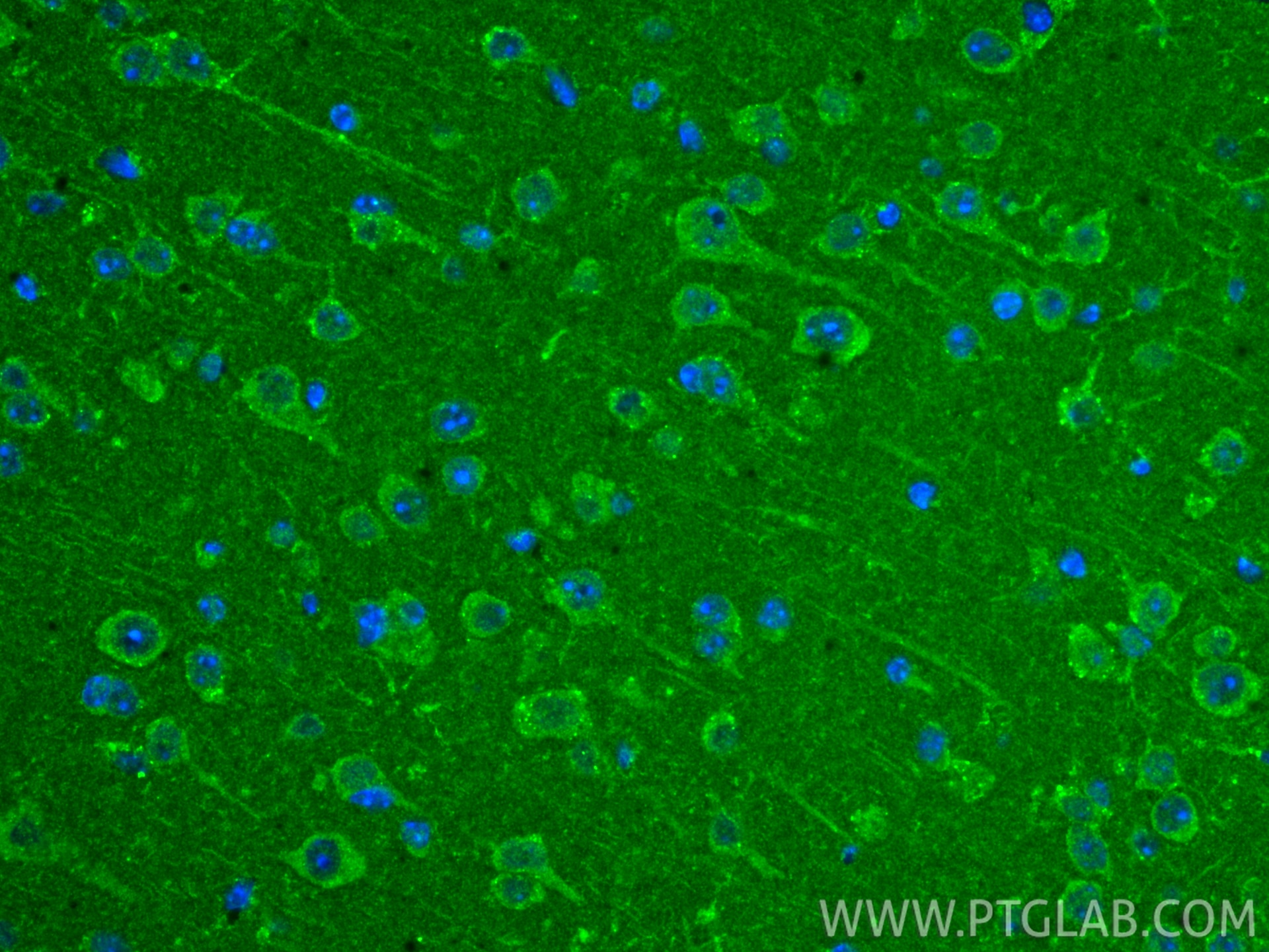 IF Staining of mouse brain using 60195-1-Ig (same clone as 60195-1-PBS) Immunofluorescence (IF) / fluorescent staining of mouse brain tissue using TMEM70 Monoclonal antibody (60195-1-Ig)