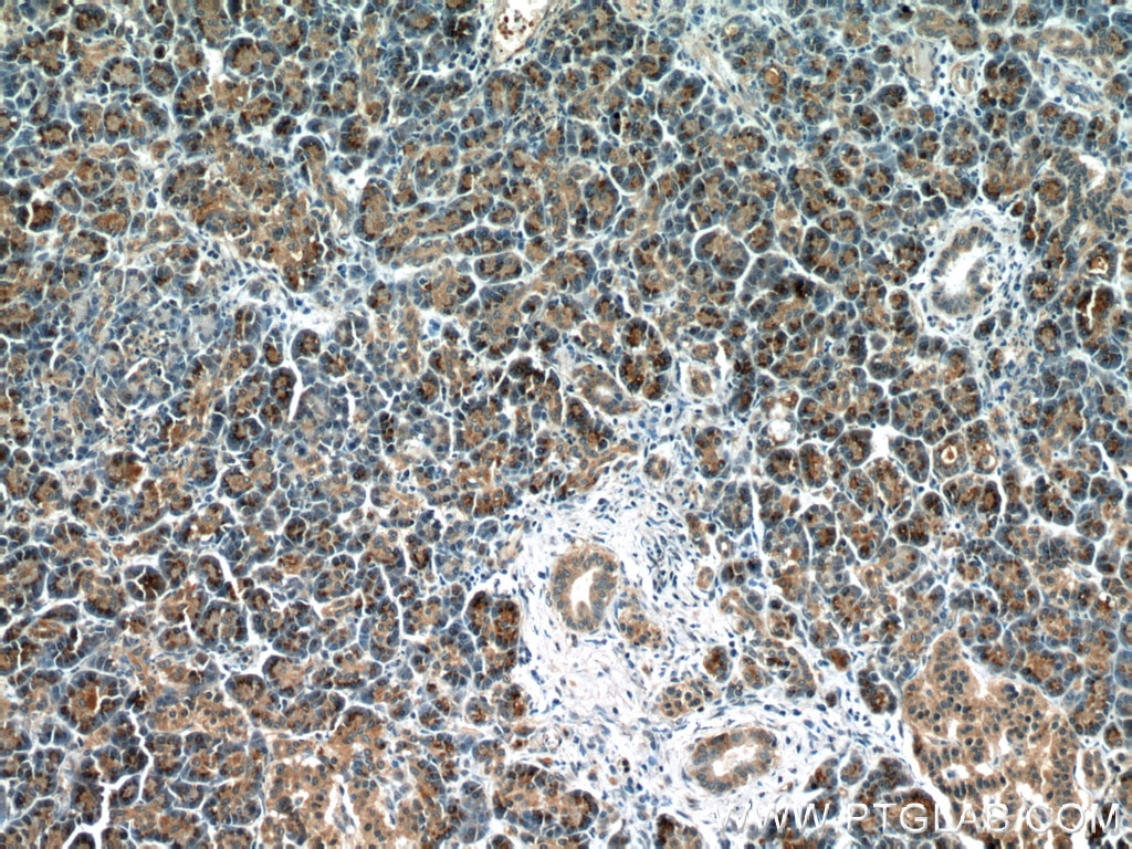 IHC staining of human pancreas using 60195-1-Ig