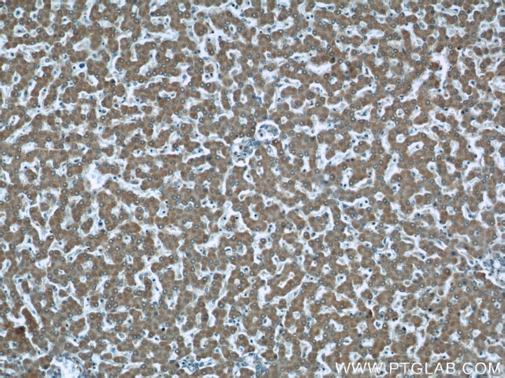 Immunohistochemistry (IHC) staining of human liver tissue using TMEM70 Monoclonal antibody (60195-1-Ig)