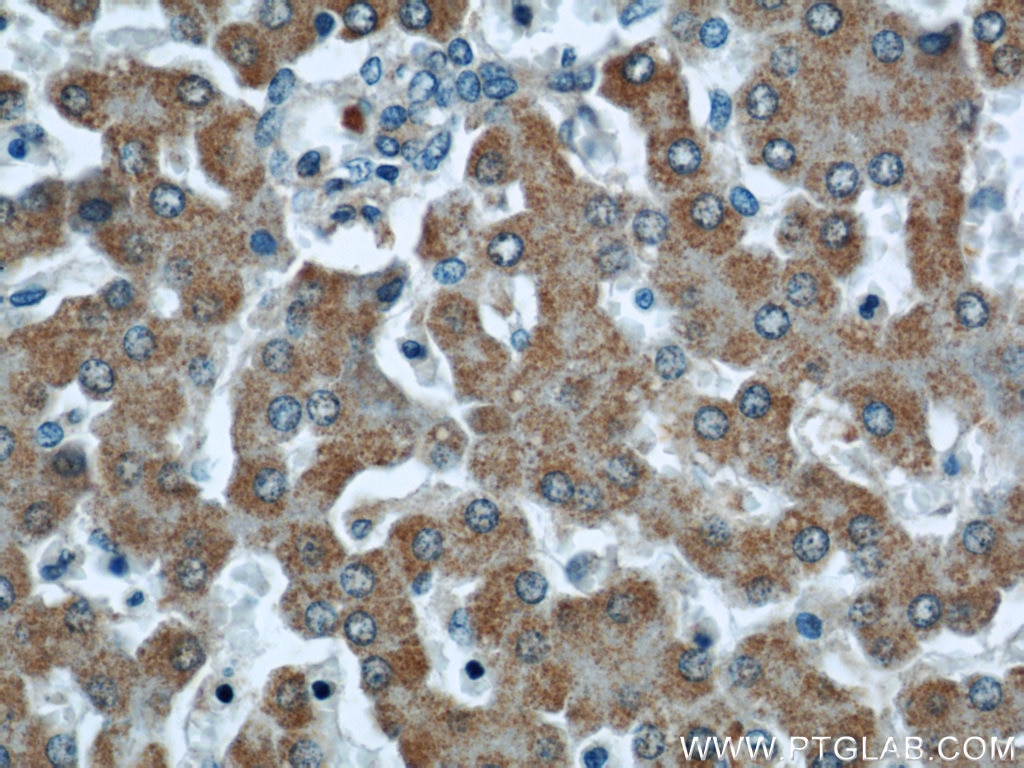 Immunohistochemistry (IHC) staining of human liver tissue using TMEM70 Monoclonal antibody (60195-1-Ig)