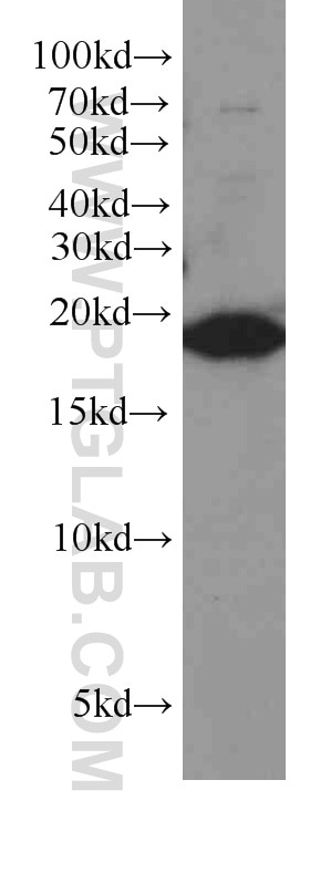 Western Blot (WB) analysis of A2780 cells using TMEM70 Monoclonal antibody (60195-1-Ig)