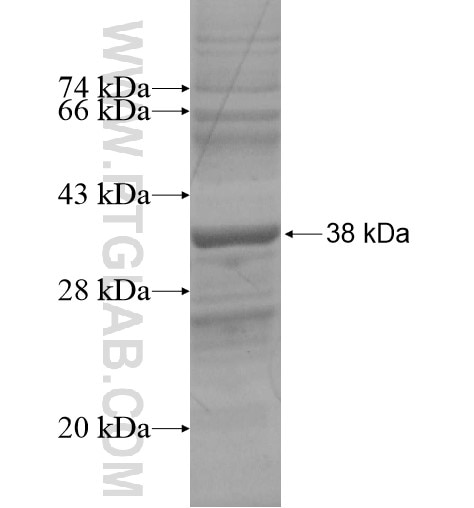 TMEM70 fusion protein Ag14226 SDS-PAGE