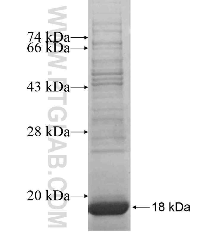 TMEM70 fusion protein Ag16947 SDS-PAGE