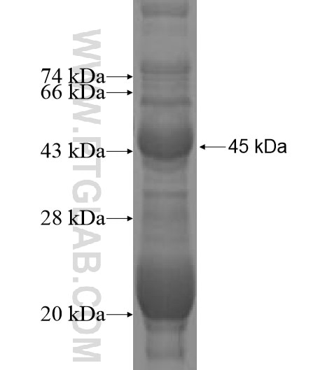 TMEM71 fusion protein Ag10161 SDS-PAGE