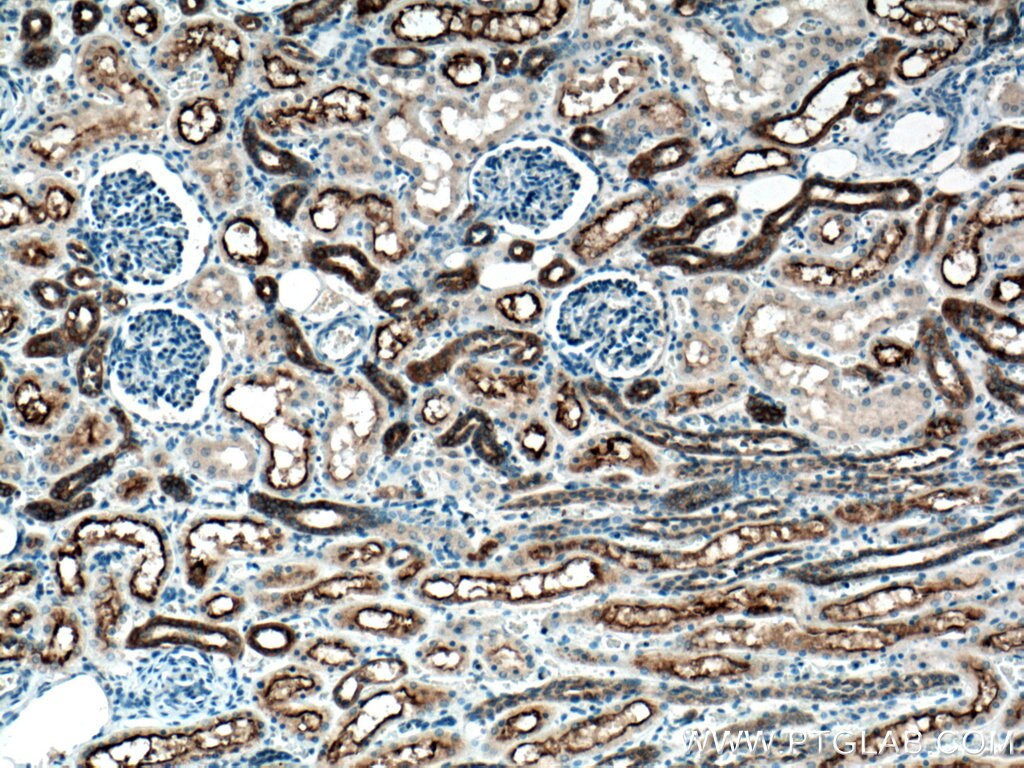 Immunohistochemistry (IHC) staining of human kidney tissue using TMEM72 Polyclonal antibody (28049-1-AP)