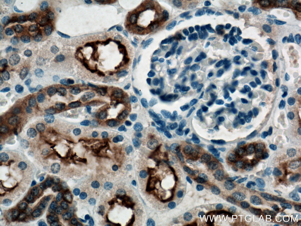 Immunohistochemistry (IHC) staining of human kidney tissue using TMEM72 Polyclonal antibody (28049-1-AP)