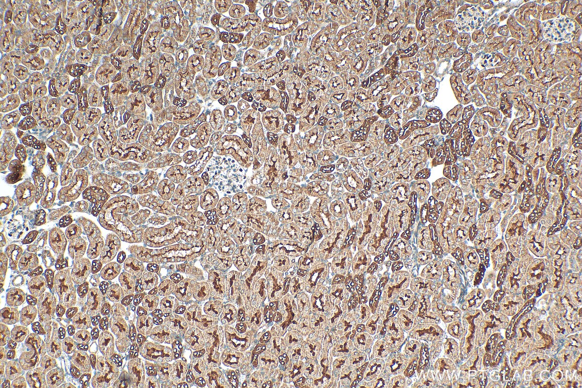 Immunohistochemistry (IHC) staining of mouse kidney tissue using TMEM72 Polyclonal antibody (28049-1-AP)