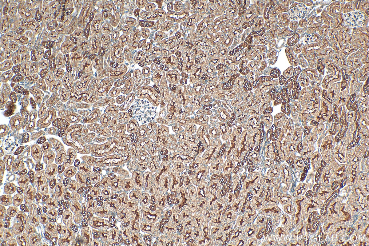 Immunohistochemistry (IHC) staining of mouse kidney tissue using TMEM72 Polyclonal antibody (28049-1-AP)