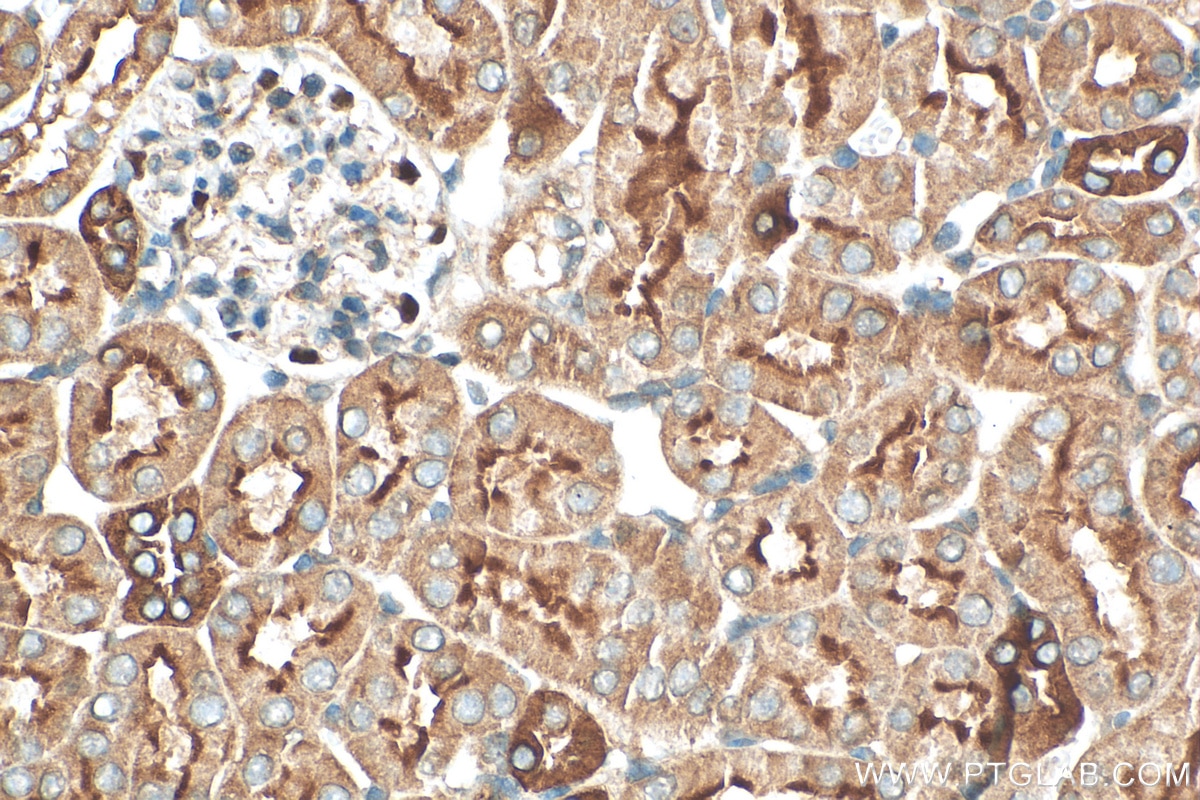 Immunohistochemistry (IHC) staining of mouse kidney tissue using TMEM72 Polyclonal antibody (28049-1-AP)