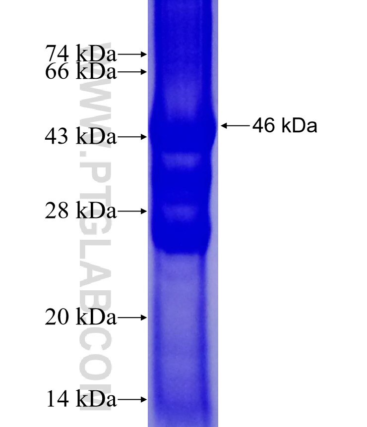 TMEM72 fusion protein Ag21553 SDS-PAGE