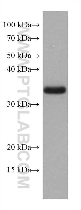 Western Blot (WB) analysis of LNCaP cells using TMEM74 Monoclonal antibody (67773-1-Ig)