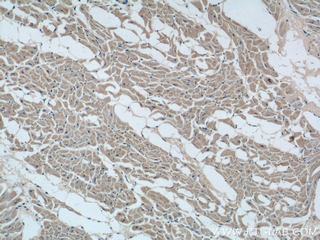 IHC staining of human heart using 23182-1-AP