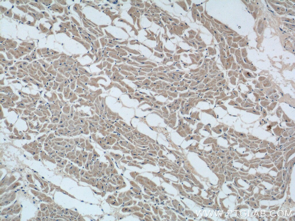 Immunohistochemistry (IHC) staining of human heart tissue using TMEM77 Polyclonal antibody (23182-1-AP)