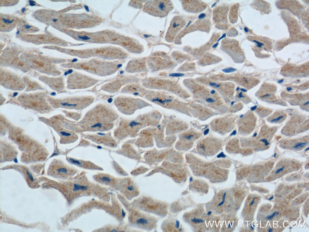 Immunohistochemistry (IHC) staining of human heart tissue using TMEM77 Polyclonal antibody (23182-1-AP)