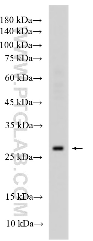 Western Blot (WB) analysis of various lysates using TMEM77 Polyclonal antibody (23182-1-AP)