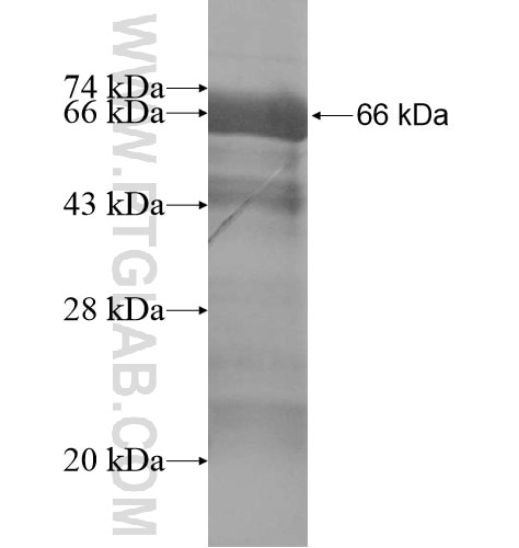 TMEM79 fusion protein Ag14803 SDS-PAGE
