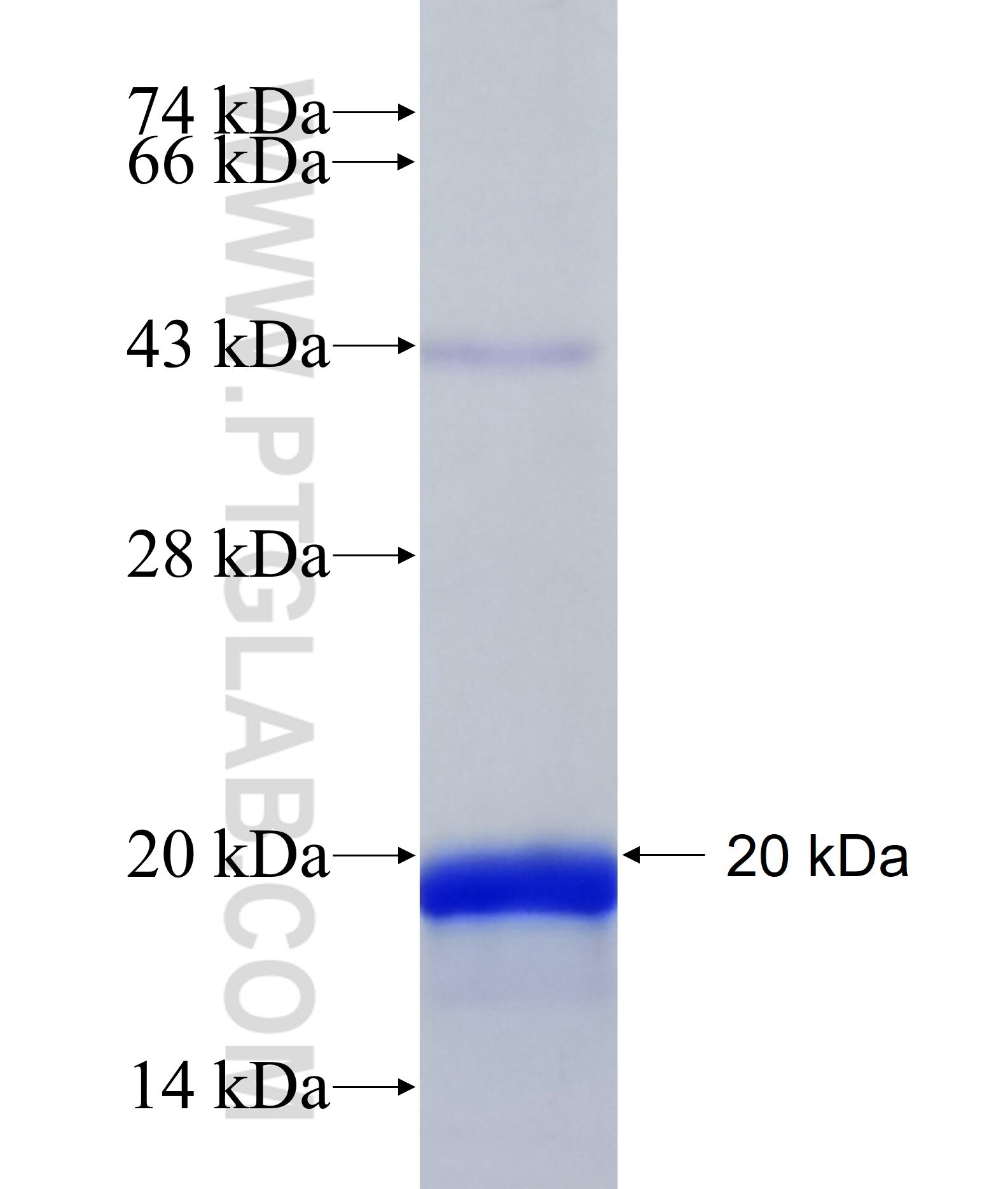 TMEM80 fusion protein Ag41271 SDS-PAGE TMEM80 fusion protein Ag41271 SDS-PAGE