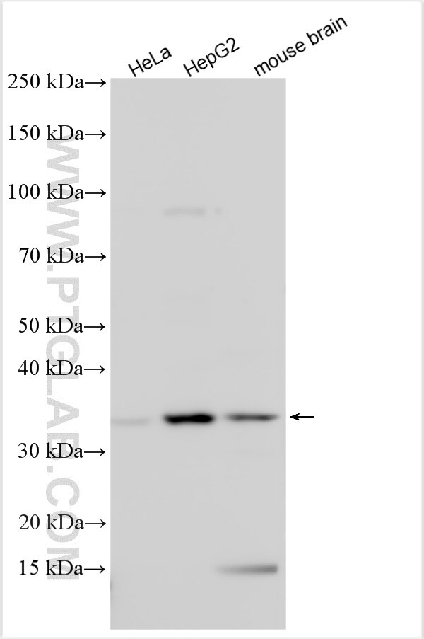 Western Blot (WB) analysis of various lysates using TMEM81 Polyclonal antibody (25634-1-AP)