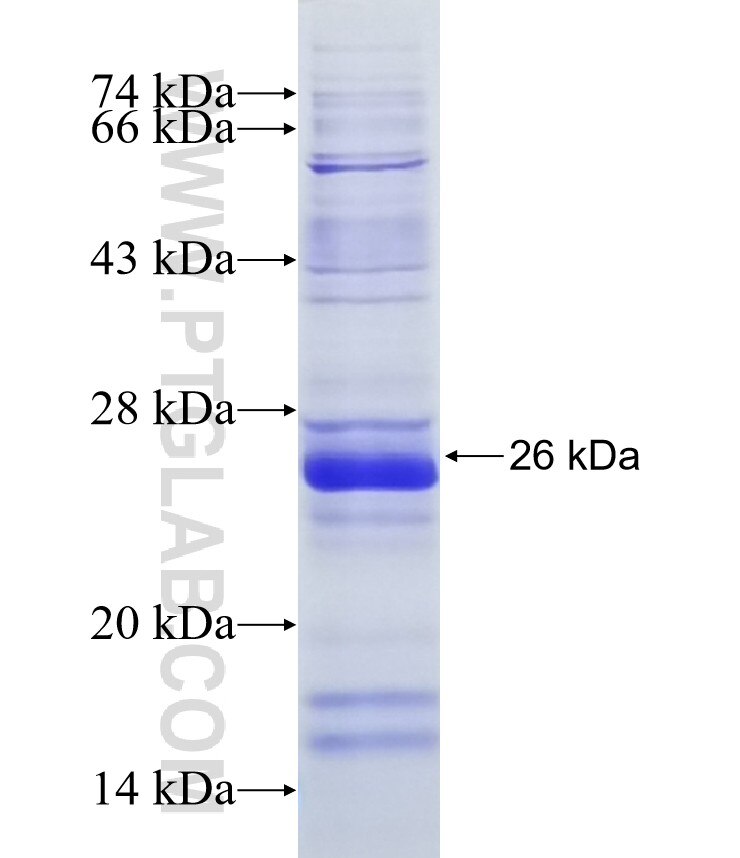 TMEM81 fusion protein Ag22367 SDS-PAGE
