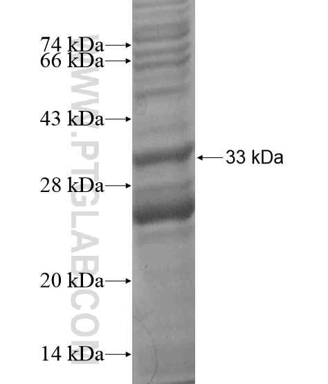 TMEM82 fusion protein Ag19636 SDS-PAGE