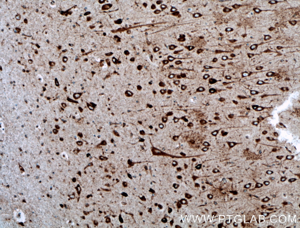 Immunohistochemistry (IHC) staining of human brain tissue using TMEM85 Polyclonal antibody (27708-1-AP)