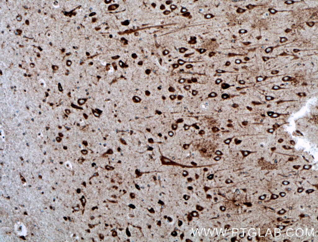 IHC staining of human brain using 27708-1-AP