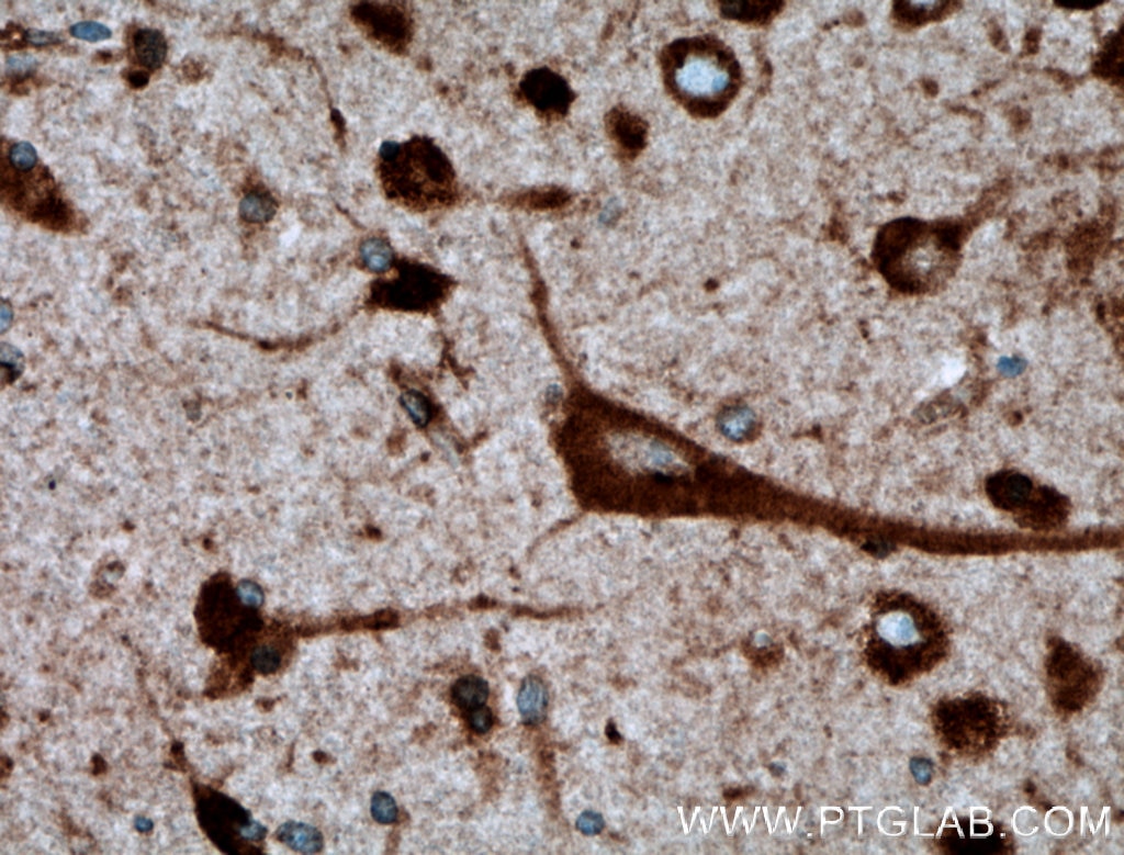 Immunohistochemistry (IHC) staining of human brain tissue using TMEM85 Polyclonal antibody (27708-1-AP)