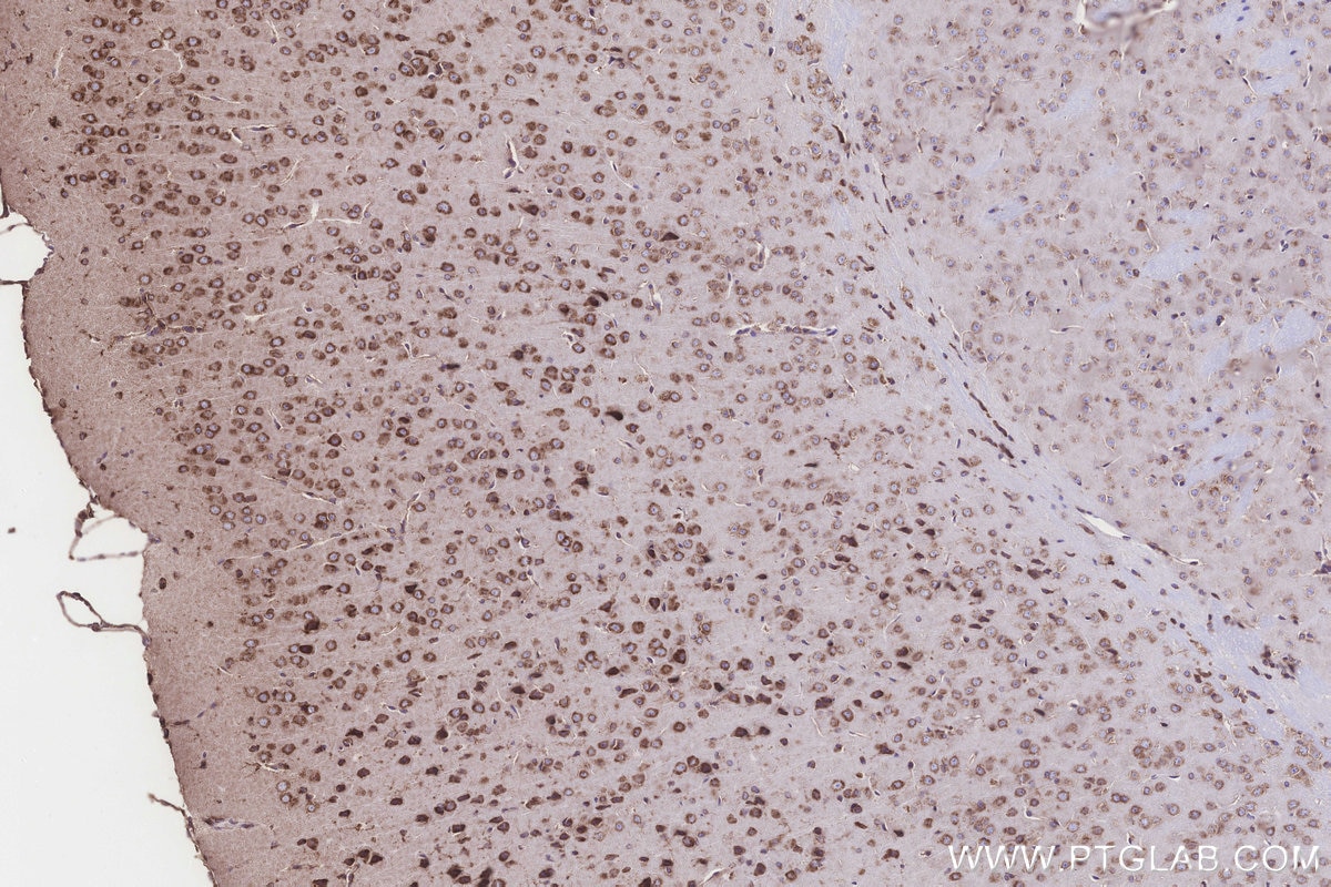 Immunohistochemistry (IHC) staining of mouse brain tissue using TMEM85 Polyclonal antibody (27708-1-AP)