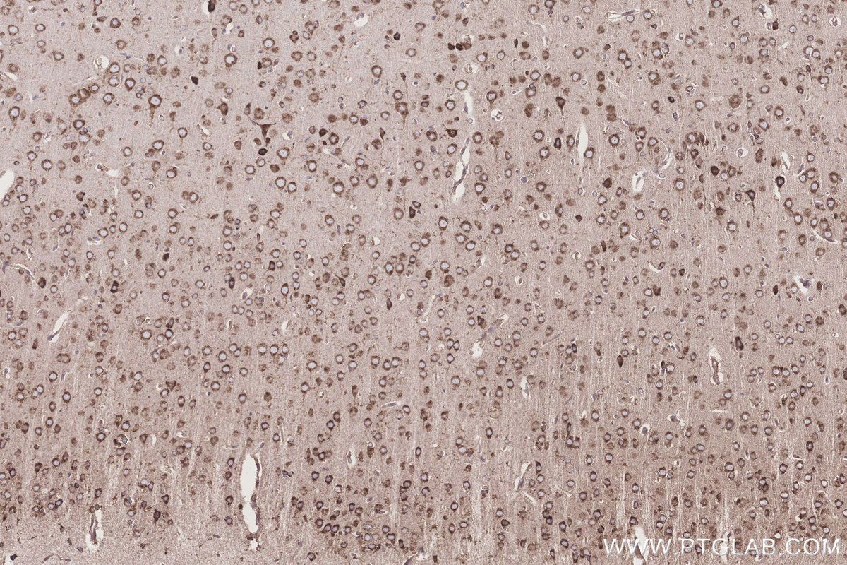 Immunohistochemistry (IHC) staining of rat brain tissue using TMEM85 Polyclonal antibody (27708-1-AP)