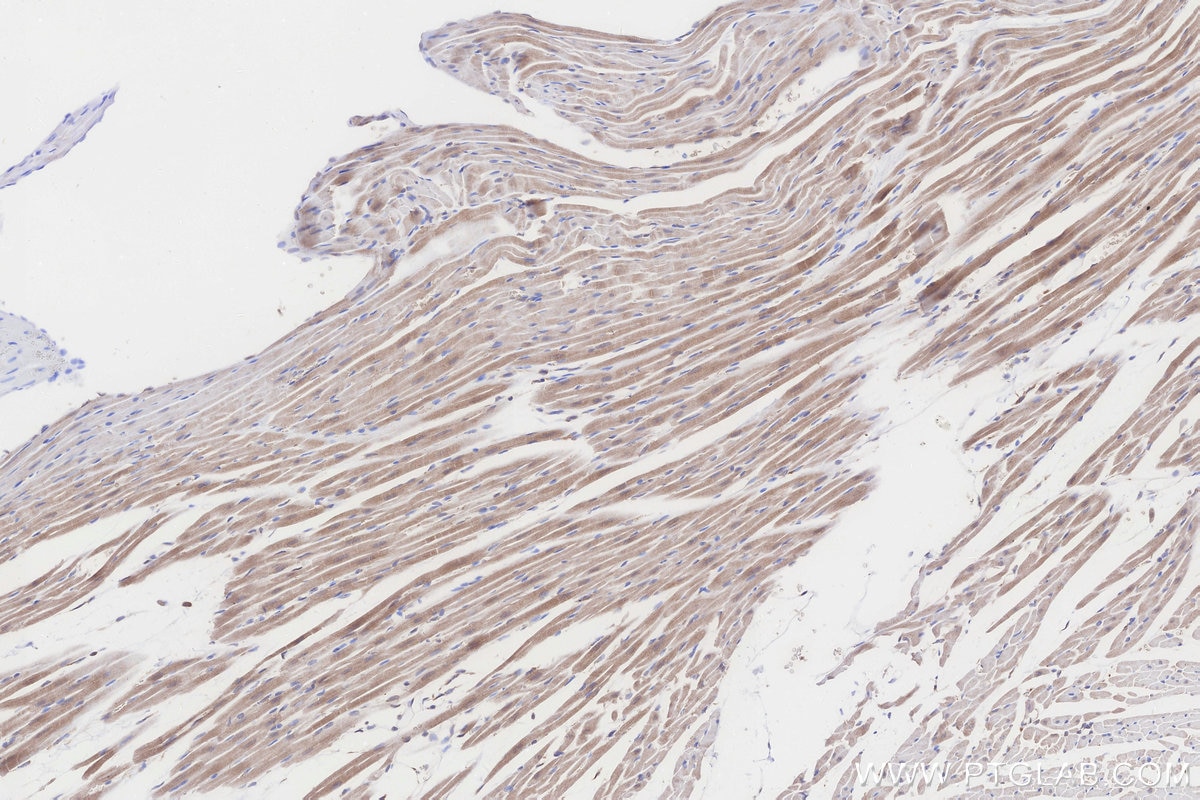 Immunohistochemistry (IHC) staining of rat heart tissue using TMEM85 Polyclonal antibody (27708-1-AP)