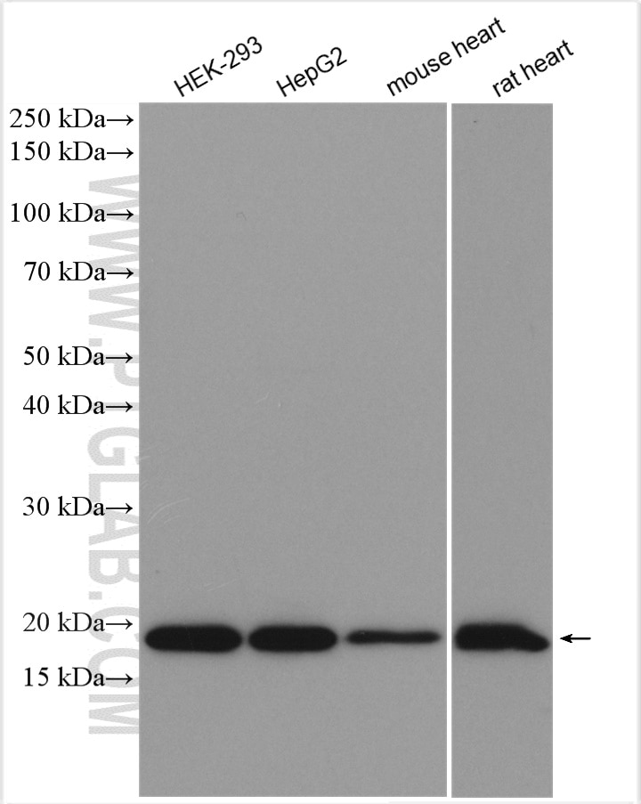 Western Blot (WB) analysis of various lysates using TMEM85 Polyclonal antibody (27708-1-AP)