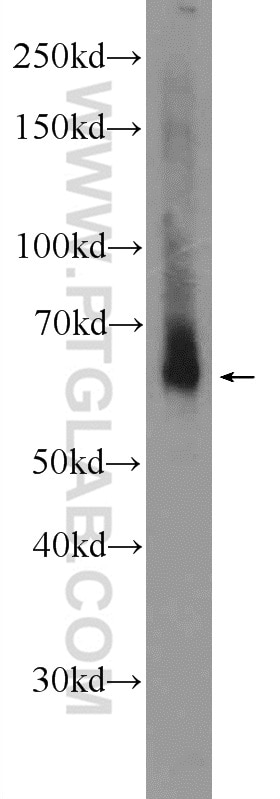 Western Blot (WB) analysis of PC-3 cells using TMEM87A Polyclonal antibody (25091-1-AP)