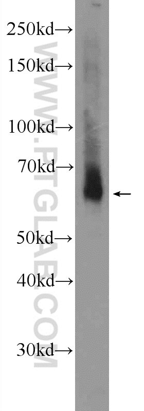 WB analysis of PC-3 using 25091-1-AP