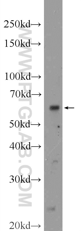 Western Blot (WB) analysis of MDA-MB-453s cells using TMEM87A Polyclonal antibody (25091-1-AP)