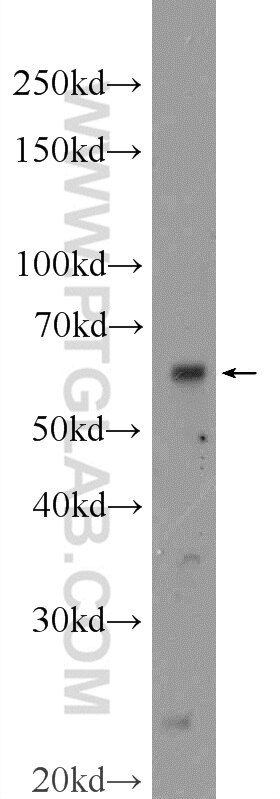 WB analysis of MDA-MB-453s using 25091-1-AP