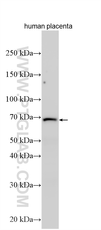 Western Blot (WB) analysis of various lysates using TMEM87B Polyclonal antibody (21889-1-AP)