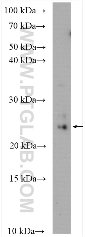 Western Blot (WB) analysis of LNCaP cells using TMEM9 Polyclonal antibody (19918-1-AP)