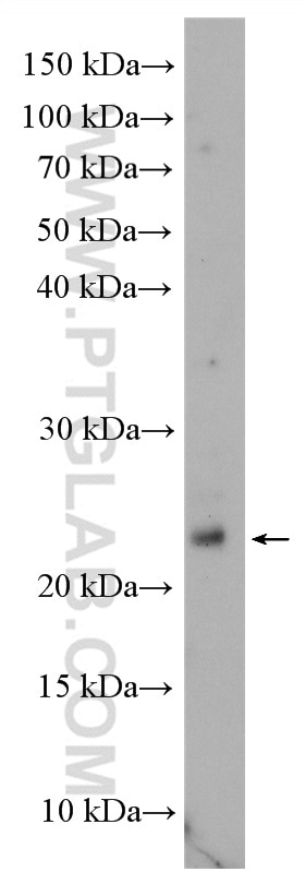 Western Blot (WB) analysis of LNCaP cells using TMEM9 Polyclonal antibody (19918-1-AP)