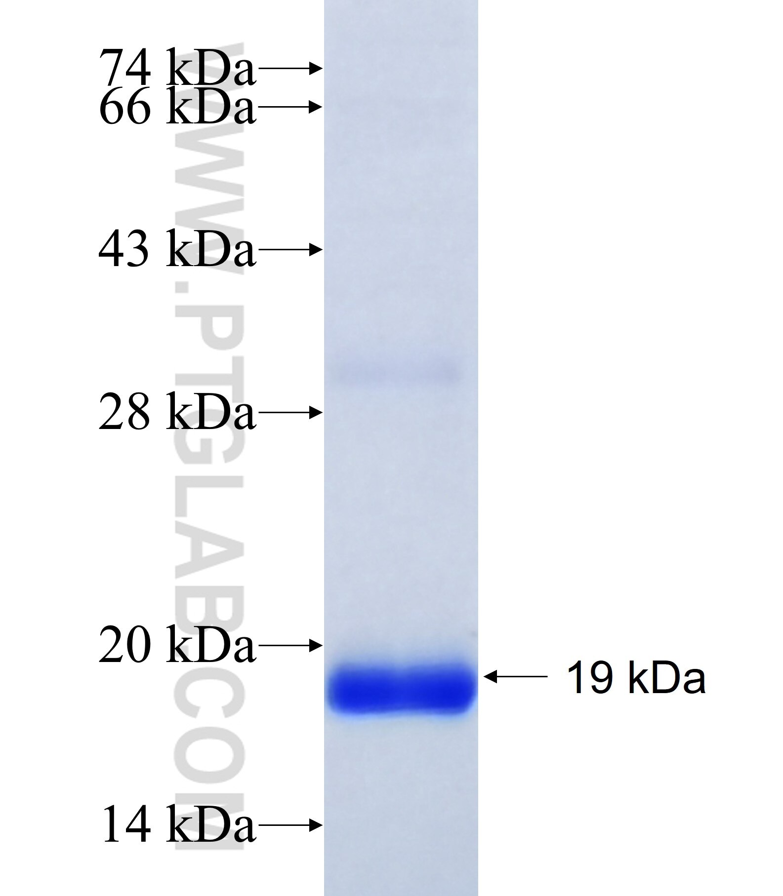 TMEM93 fusion protein Ag41566 SDS-PAGE