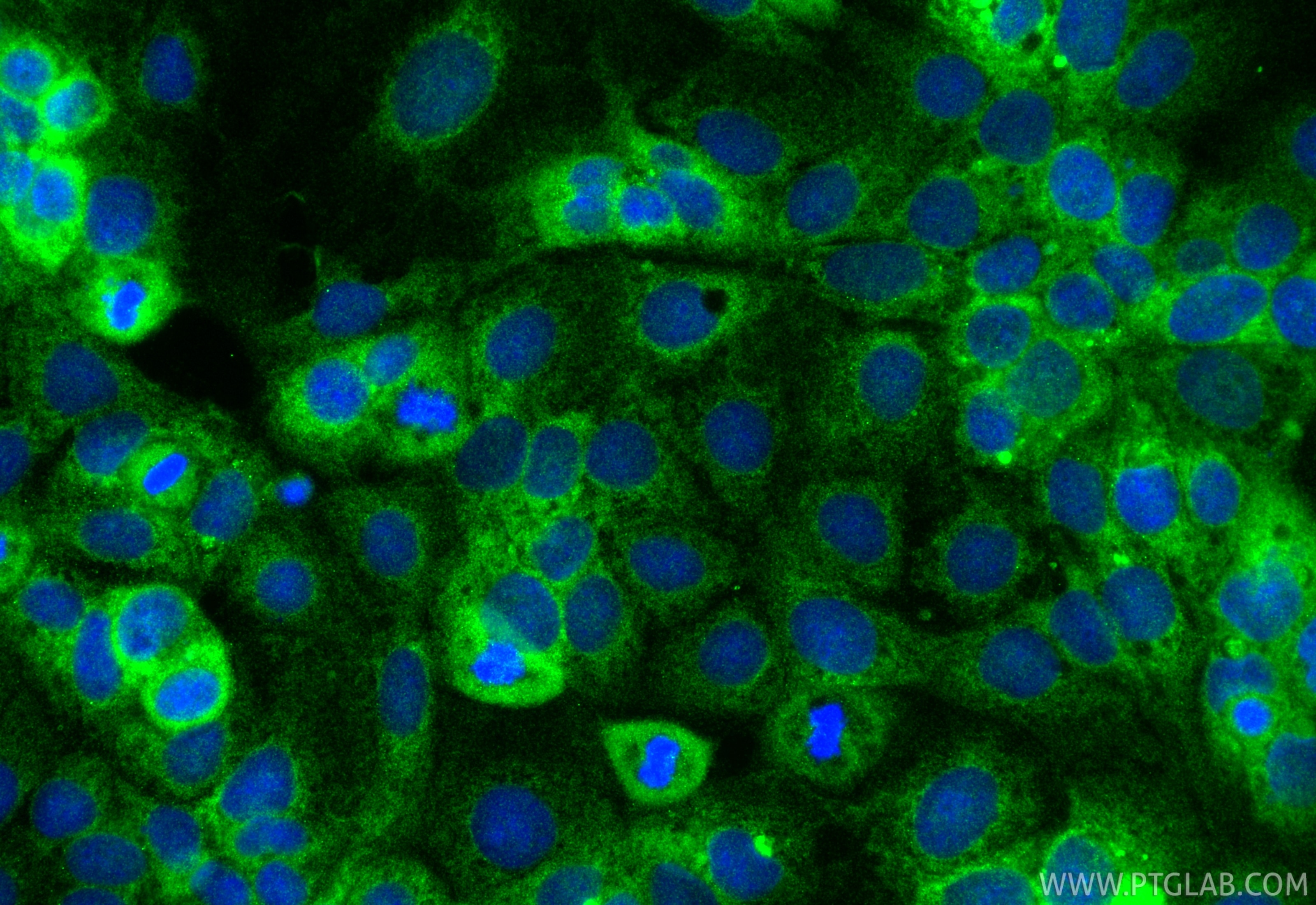Immunofluorescent analysis of (-20°C Ethanol) fixed Caco-2 cells using TMEM97 antibody (26444-1-AP) at dilution of 1:300 and CoraLite®488-Conjugated Goat Anti-Rabbit IgG(H+L) (SA00013-2). Immunofluorescence (IF) / fluorescent staining of Caco-2 cells using TMEM97 Polyclonal antibody (26444-1-AP)