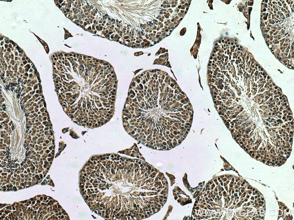 Immunohistochemistry (IHC) staining of mouse testis tissue using TMEM97 Polyclonal antibody (26444-1-AP)