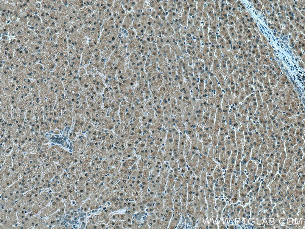 Immunohistochemistry (IHC) staining of human liver tissue using TMEM97 Polyclonal antibody (26444-1-AP)