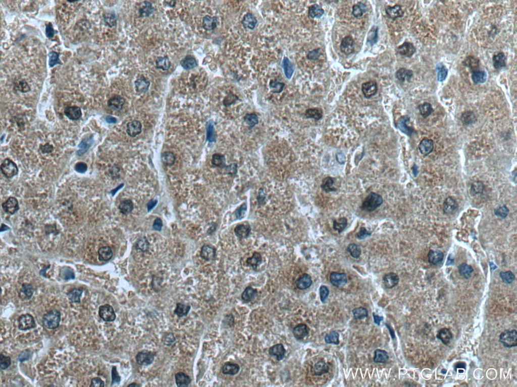 Immunohistochemistry (IHC) staining of human liver tissue using TMEM97 Polyclonal antibody (26444-1-AP)