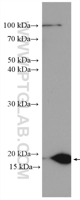 Western Blot (WB) analysis of mouse testis tissue using TMEM97 Polyclonal antibody (26444-1-AP)
