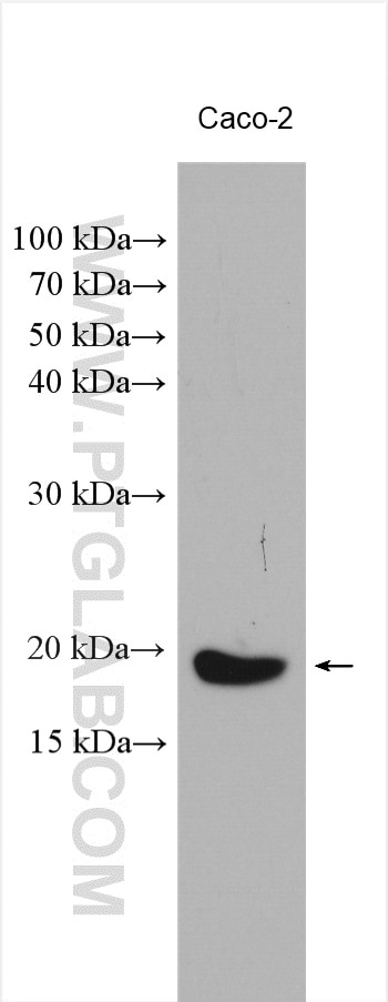 Western Blot (WB) analysis of various lysates using TMEM97 Polyclonal antibody (26444-1-AP)