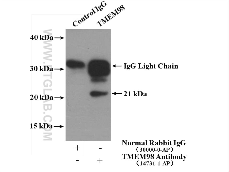 Immunoprecipitation (IP) experiment of Y79 cells using TMEM98 Polyclonal antibody (14731-1-AP)