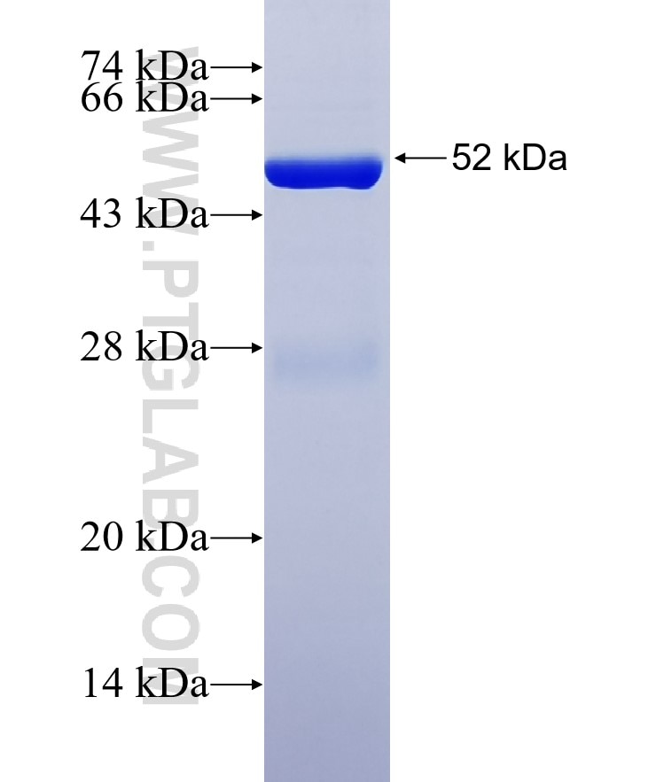 TMEM98 fusion protein Ag6492 SDS-PAGE