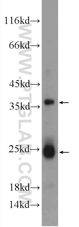 Western Blot (WB) analysis of rat liver tissue using TMEM9B Polyclonal antibody (24331-1-AP)